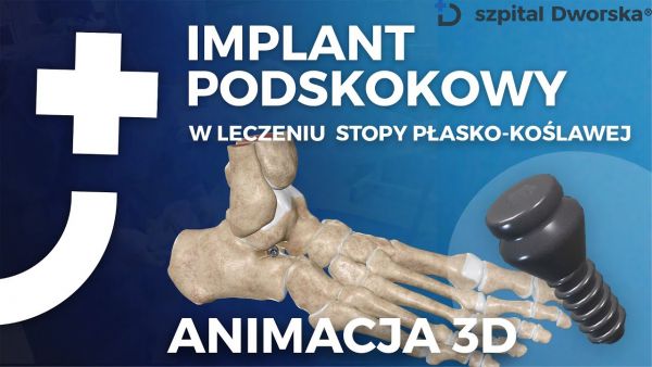 Implant podskokowy leczeniu